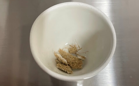 人的ミスを防ぐための検体登録